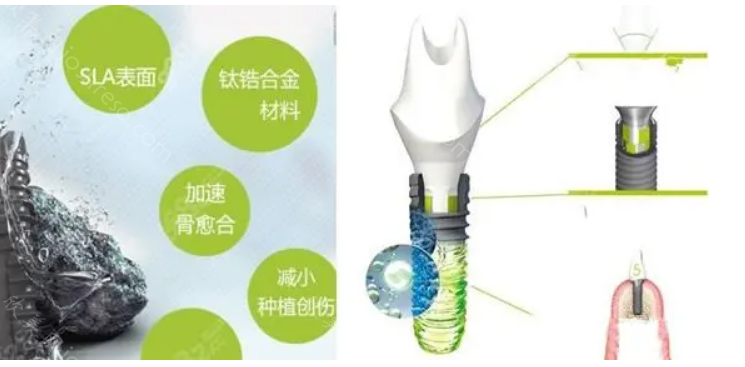 乐山达芬奇口腔医院怎么样?看正规性和价格表你就明白了!