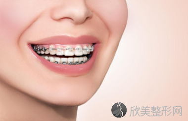 上海口腔医院牙科收费价目表：牙齿矫正价格要清晰