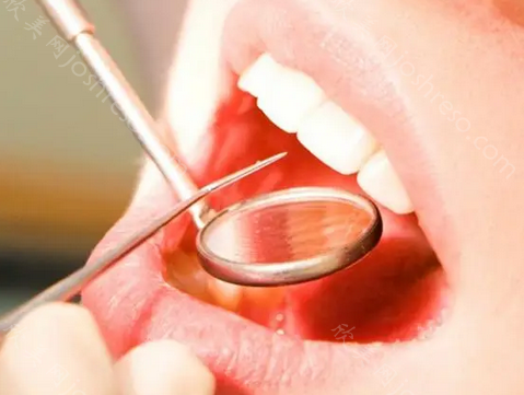 大连牙元素口腔种植牙多少钱?医生技术精湛,客户评价都说好!