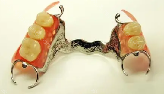 耀世美成齿科种植牙和义齿价格表,耀美恒义齿优点有哪些？