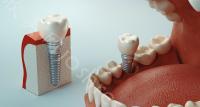 在线查收沈阳盛大口腔医院种植牙收费标准，各类植牙品牌都有！
