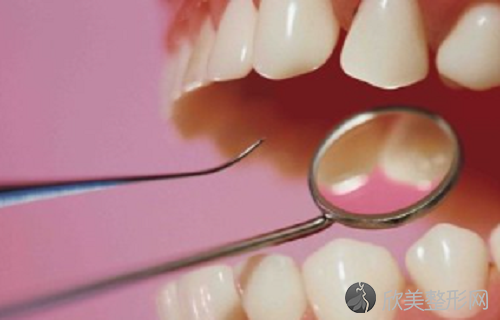 52岁牙齿修复树脂贴面和瓷贴面哪个更适合？牙齿修复其他方式也要了解