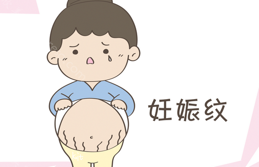 七年妊娠纹做激光能去掉吗?告别多年妊娠纹一点都不难