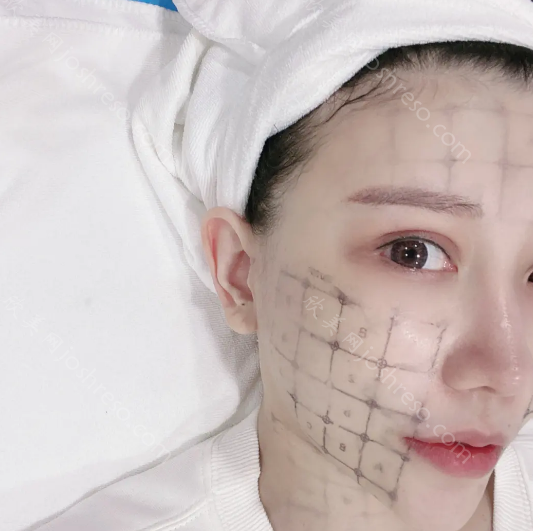 深圳米兰柏羽热玛吉怎么样?认证医生有哪些?