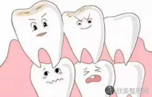 恒牙和乳牙哪个更长？牙齿需特别注重清洁护理