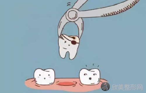 根管治疗拔牙哪个疼？根管治疗的疼痛管理方法要知道