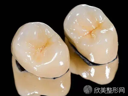 全瓷牙套哪个好?全瓷牙品牌十大哪家好!这几个全瓷牙品牌质量好!