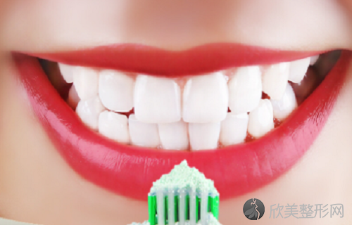 美白牙素和牙贴哪个好？牙贴更换周期要注意