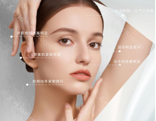 广州广美去皱纹怎么样?面部除皱优势明显，效果好!