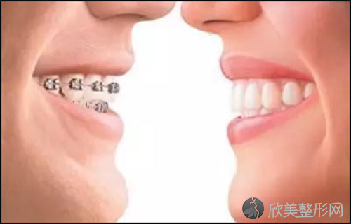 哪个医院做正畸好？正畸方法有哪些？国内这几所医院不容错过！