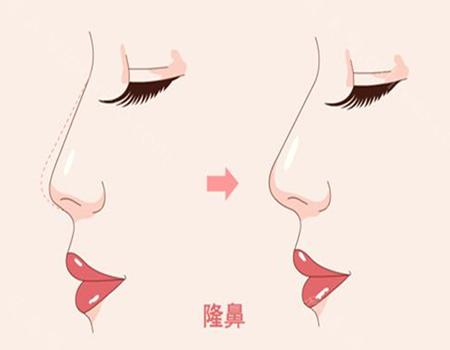 美莱整形是正规医院吗?优势项目+口碑点评,戳进来看简介!