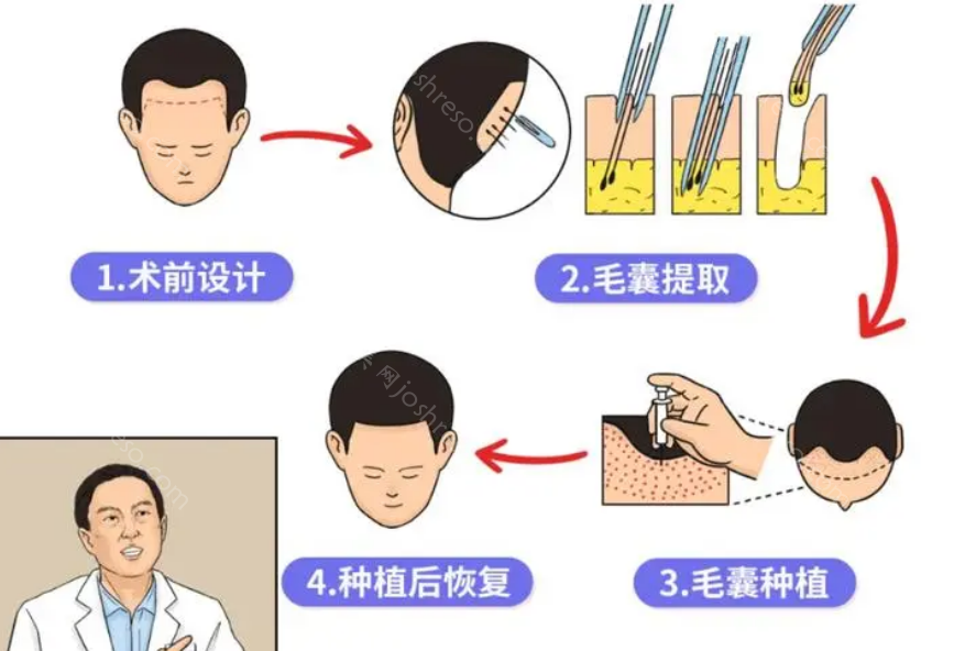 合肥新生植发医院怎么样?哪些医生技术好?附医院地址价格!