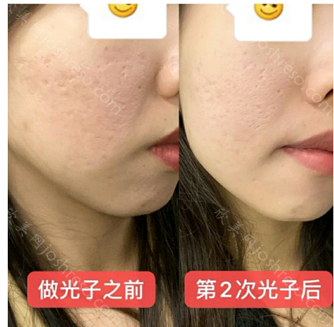 长春麦西美嘉医疗美容医院正规吗?医院介绍/价格表/案例等揭晓!