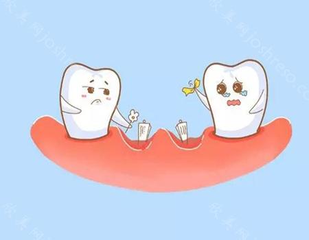 老人假牙的种类及价格怎么样?义齿和假牙是一样的吗?
