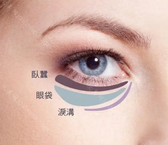 云南美诗沁眼部整形怎么样?祛眼袋技术在线，实力不可小觑!