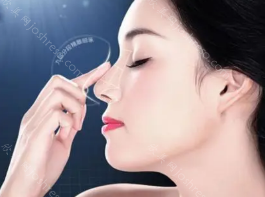 杭州艺星张龙做鼻子怎么样?风格自然，鼻部整形技术太赞了!