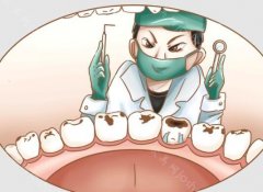 为什么补牙医生不建议用树脂的原因?常用材料分享