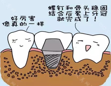 网上买的树脂补牙能不能用?补牙的费用大概是多少?