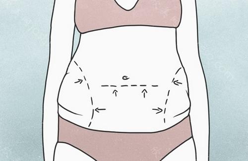 腰腹环吸怎么样以及吸脂部位有哪些?腰腹环吸大概多少钱?