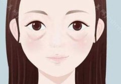 割眼袋2年后是什么样?手术过程揭秘-附术后图