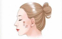 拉皮手术为什么耳朵容易变形?点击了解下相关的资讯
