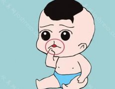 先天性唇腭裂手术国内免费吗?含有唇腭裂手术价格以及科普知识