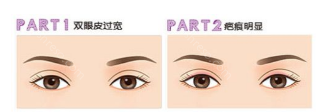 达州现代整形美容医院双眼皮整形怎么样?专业靠谱吗?
