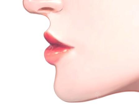 手术矫正嘴凸一般需要多少钱?分析凸嘴形成的原因和术后护理方案