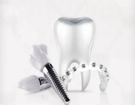 听说已有新技术替代种牙?种植牙之后应该如何护理?