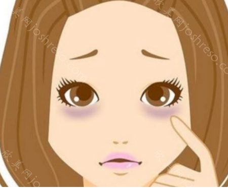上海美诗沁去眼袋效果好吗?技术不错，效果明显!