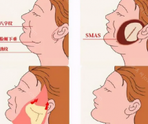 南京拉皮手术价格多少钱?颈部/面部拉皮等价格表一览!