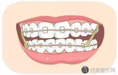 广州广大口腔价格一览：附医生信息以及牙齿矫正介绍！
