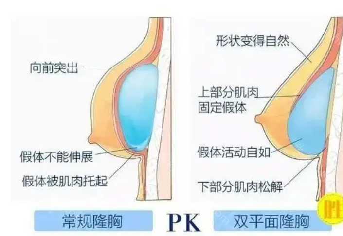 达州韩美医疗美容整形诊所隆胸价格贵吗?隆胸技术优势明显，价格不贵!