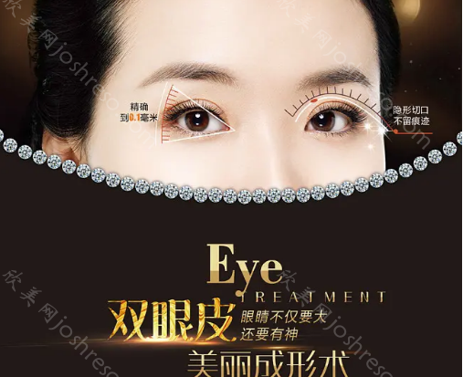 杭州维多利亚双眼皮技术如何?双眼皮价格不贵，医生实力坐诊!
