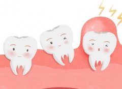 乳牙期矫正的适应症是什么?乳牙期矫正的费用高吗