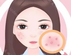 百肤谜小魔瓶价格是多少?科普品牌价格和作用