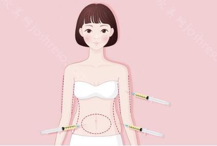 牡丹江整形美容医院收费明细公示:割双眼皮,隆胸,抽脂要多少钱?