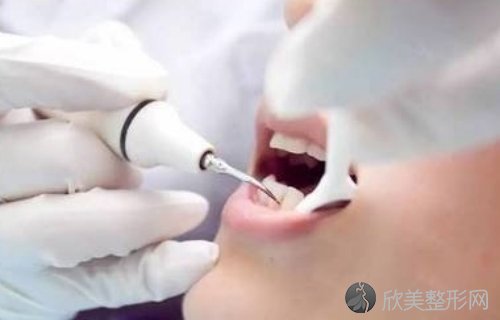 上海泰康拜博六和口腔门诊部收费价格一览：热门项目推荐，种植牙案例真实反