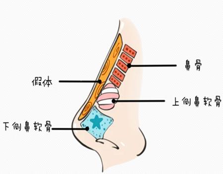 北京伟力嘉美信医疗美容线雕隆鼻费用多少钱?客户口碑如何?咨询必看