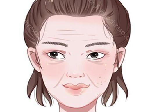 填充法令纹价格曝光一览?分享实力医院信息~价格查看