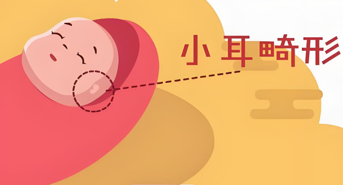 耳基底提升整形：非手术美学新选择