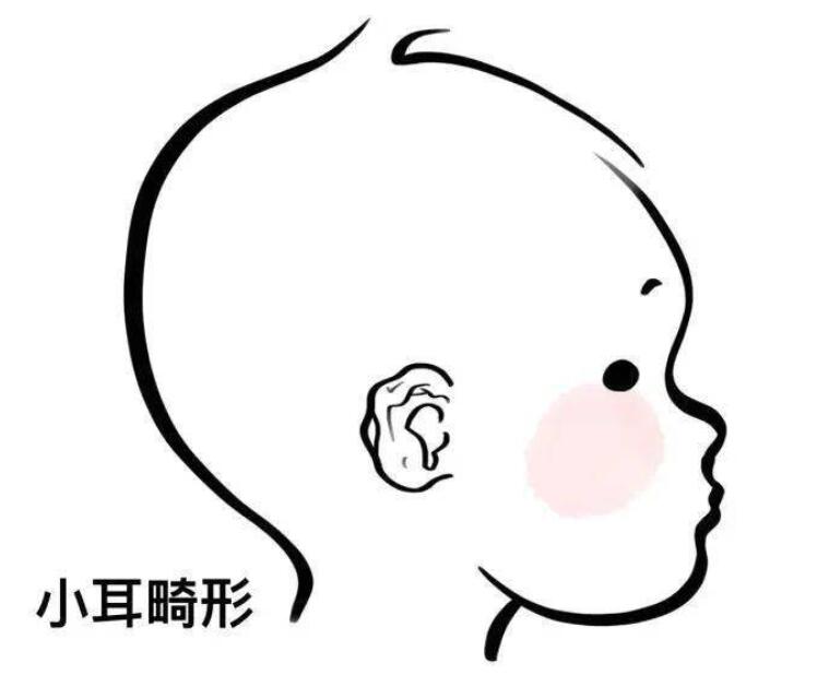 深圳耳部整形专家医生推荐，技术精湛受好评