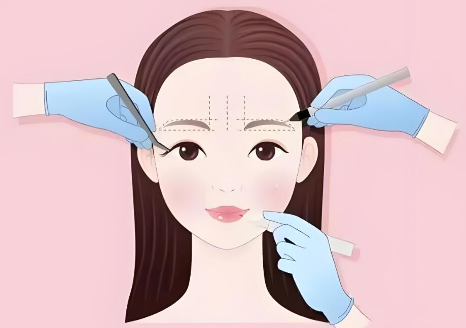 开眼角手术：适合人群与注意事项