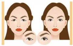 眼周筋膜悬吊：抗衰美容的新选择