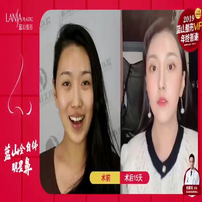 石家庄蓝山医院整形美容项目价格表一览，价格表及性价比分析