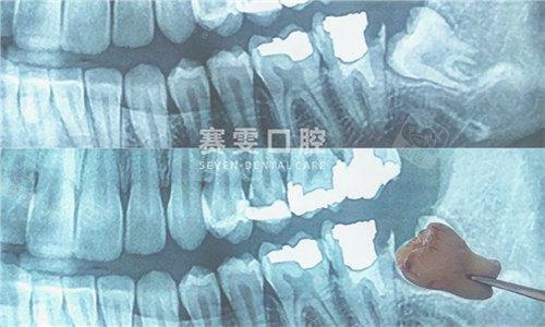 郑州德韩口腔门诊部医生有哪些擅长项目？是否包含牙齿矫正？