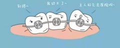 成都牙齿矫正医院哪家好？技术怎么样？代表医生介绍一览