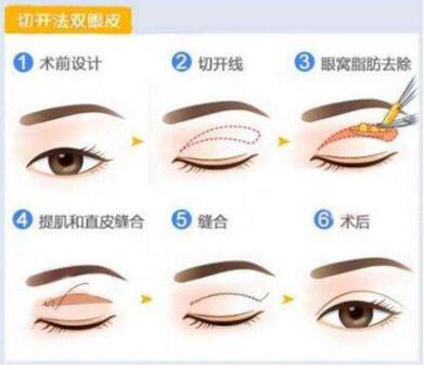 温州微整去皱纹大型正规美容医院排行榜前十哪家医院较好？温州妃悦医疗美容