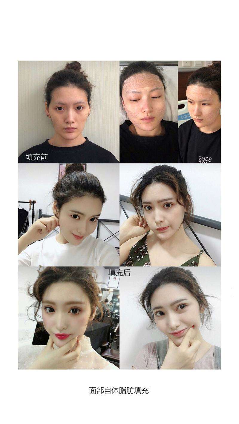 大理正规美容整形医院排名（排行）更新！韩美医疗美容、大理白族自治州人民