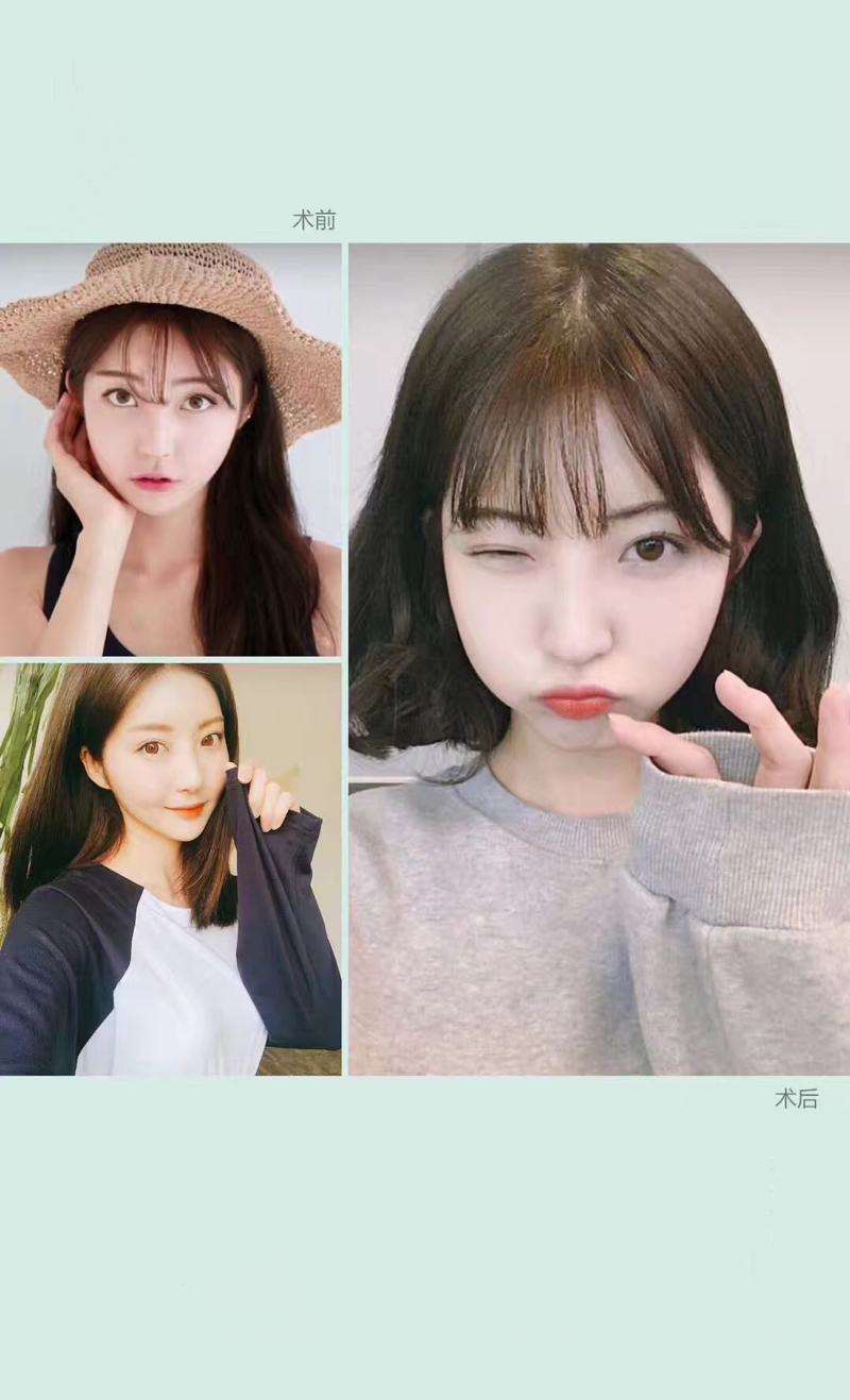 大理整形医院排名前六强抢先看，排名前六的有韩美医疗美容、大理白族自治州